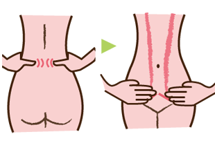 お腹のくびれを作るそけい部リンパ流し